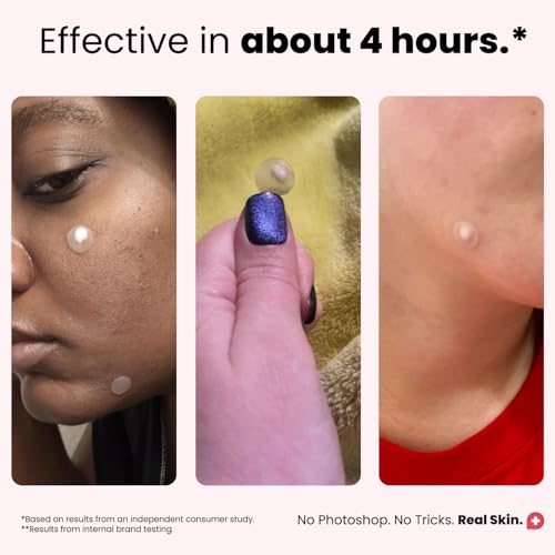Hydrocolloid Acne Patches - 90 Vegan Pimple Patches with BHA & Tea Tree Oil