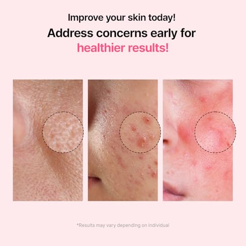 VEGANIFECT Pore Refining Ampoule with Fig & Chestnut Niacinamide – 8 Plant Extracts