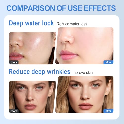 Collagen Facial Masks Set - 5 Hydrating Sheet Masks for All Skin Types