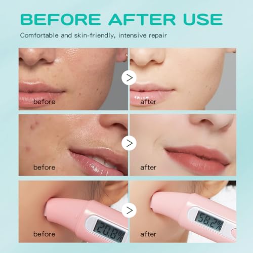 GUOYAOLIFU Hydrating Face Mask Set for All Skin Types - 6 Pack