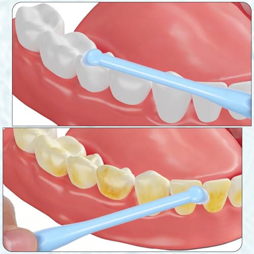 4-Pack Soft End Tuft Toothbrushes for Braces - Compact & Gentle