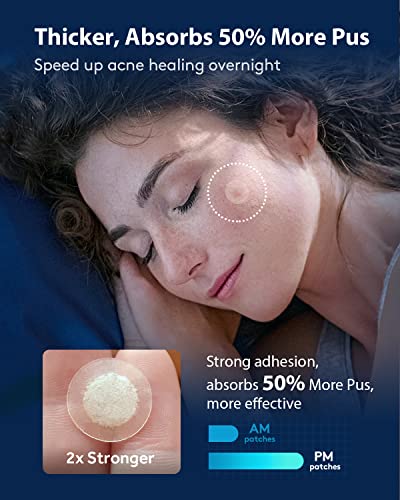 LitBear 360 Count Acne Pimple Patches - Day & Night Hydrocolloid Zit Stickers with Witch Hazel, Tea Tree & Calendula Oil, Multiple Sizes