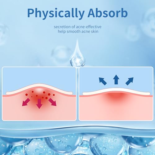 Daolyo 300 Pimple Patches for Face - 4 Sizes Hydrocolloid Acne Spot Treatment
