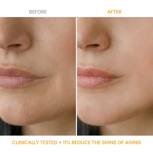 #OOTD Snail Mucin Face Moisturizer Cream - Fragrance-Free Anti-Aging Hydrating Skin Care