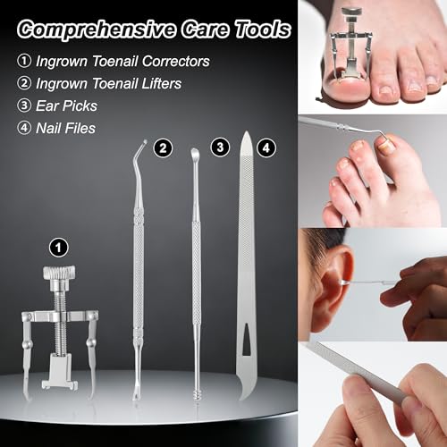VOCOSTE 13-Piece Ingrown Toenail Care Kit - Professional Pedicure Set for Home & Travel