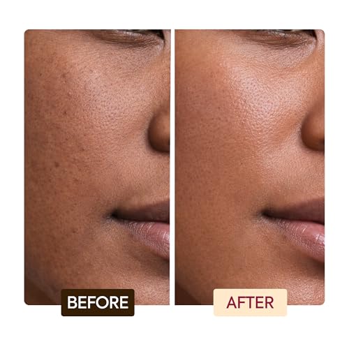 MAKARI Classic Exfoliating Antiseptic Soap - Brightening Bar, 7 oz