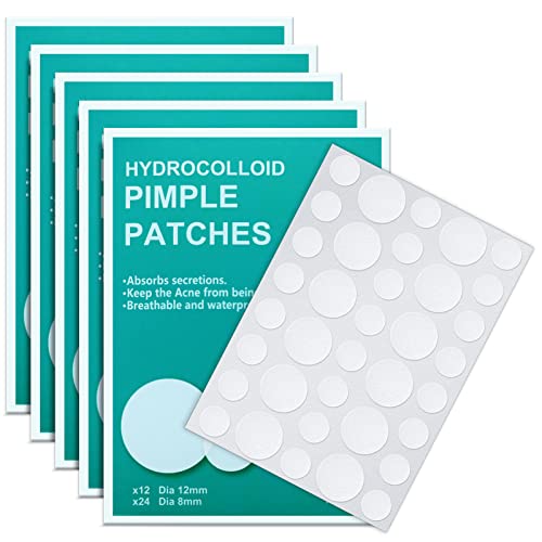 180 Hydrocolloid Acne Patches for Fast Pimple Treatment