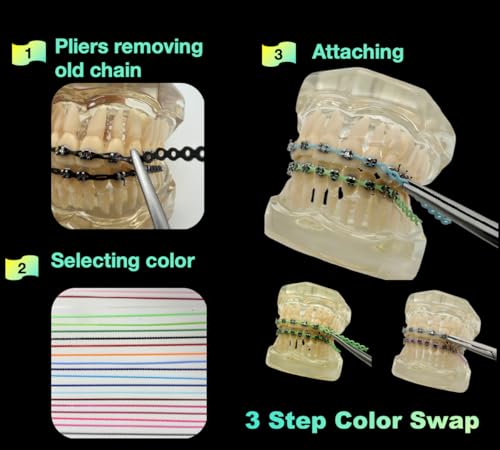 DIY Braces Power Chain Kit - 20 Multi-Color Elastic Bands & Plier