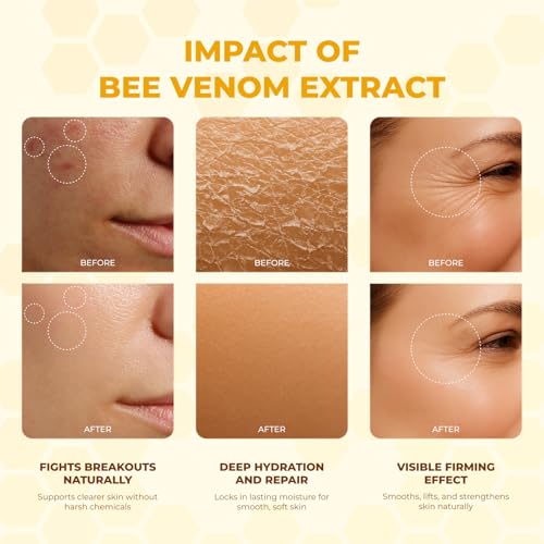 MONIER Bee Venom Cream - Hydrating & Firming Skin Treatment