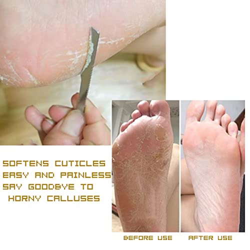 3-Piece Stainless Steel Ingrown Toenail Pedicure Knife Set