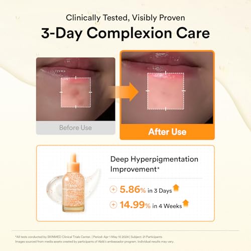 Abib Glutathiosome Dark Spot Serum – Hydrating Korean Face Serum 1.69 fl.oz.