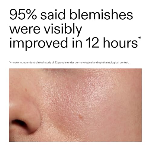 The INKEY List Succinic Acid Treatment 0.5 fl oz for Blemishes
