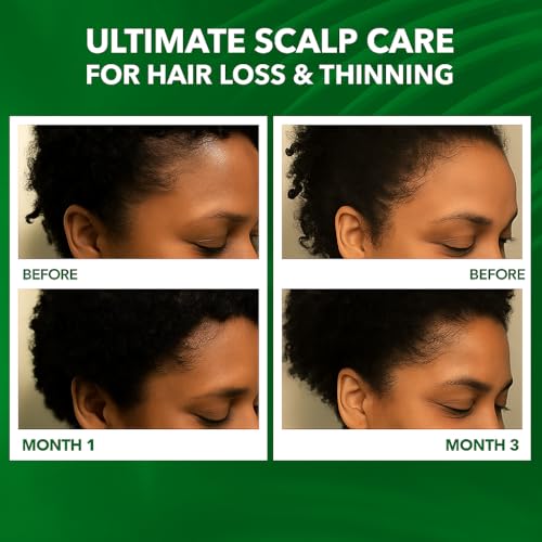 Scalp Oil for Hair Loss & Thinning Hair - Nourishing Batana & Tea Tree (60mL)