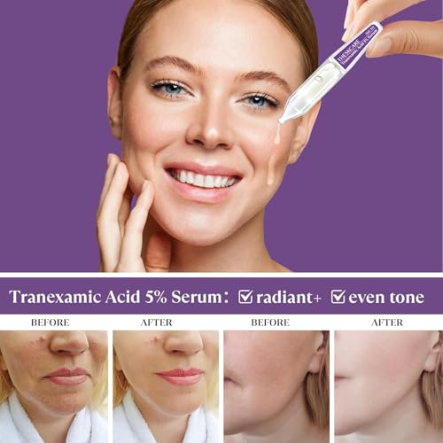 THESKCARE 5% Tranexamic Acid Serum for Dark Spots - 30ml