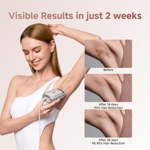 Dreame Nova IPL Hair Removal with Dual-Lamp 27J Output, Sapphire ICE Cooling, 3.9cm©÷ Window, 0.2s Flash, Adaptizone AI Detection, Photon Skincare, Up to 96% Reduction Full-Body for Women and Men
