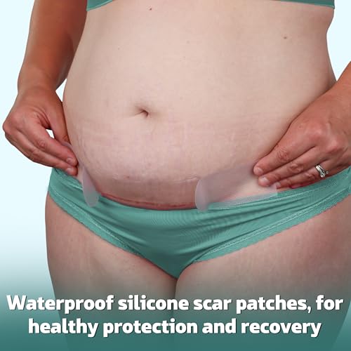 Mama & Wish¢ç C-Section Recovery Kit ? Postpartum Essentials C Section 12-Pc: Belly Binder, Silicone Scar Patches, Peri Bottle, Disposable Underwear, Wipes, Grip Socks & Toiletry Bag