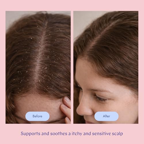 Sensitive Shampoo 10.1 Fl Oz - By Veira (Variation: Sensitive Shampoo 10.1 Fl Oz) Soothes Itchy Scalp