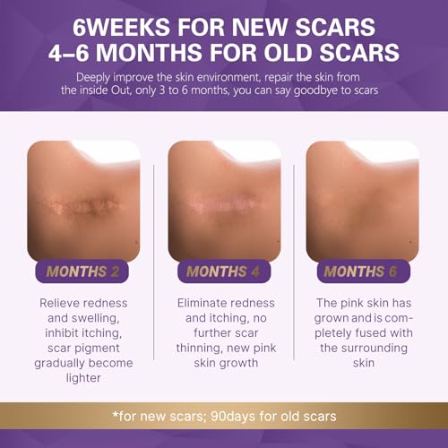 RCSCBC Scar Soothing Cream 1PCS - Advanced Silicone Scar Removal for Surgical, Acne, Burns, C-Section & Injury