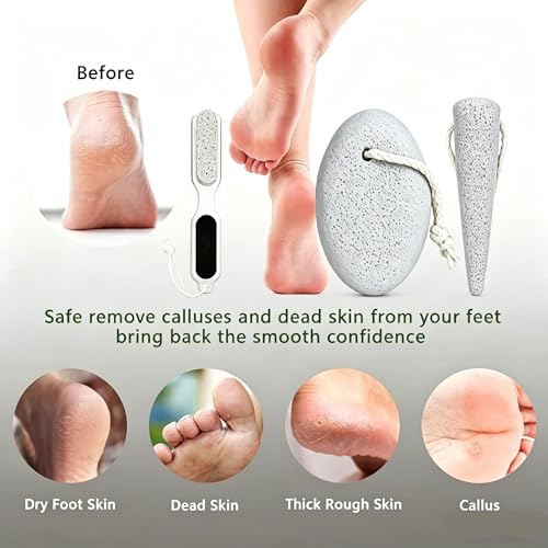 3PCS Pumice Stone Pedicure Tools Set for Exfoliating Hands & Feet