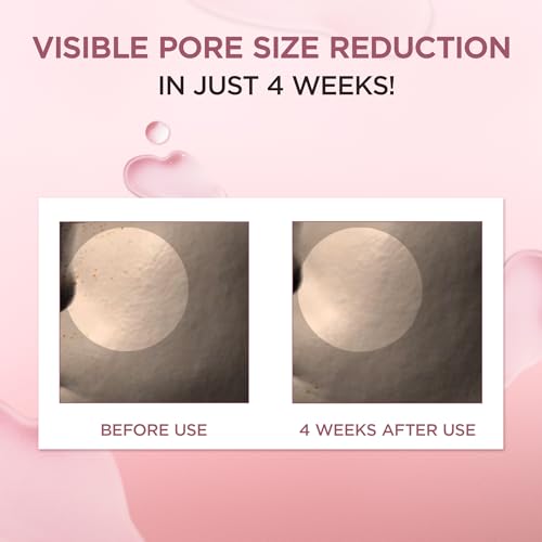 SKIN1004 Centella Pore Minimizing Serum with Pink Salt - 50ml