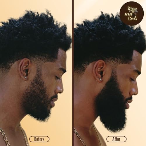 Black Seed Beard Oil for Men - Natural Growth, Hydration & Strength, 2oz