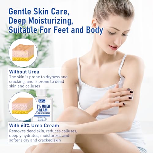 60% Urea Foot Cream with Salicylic Acid - Deep Moisturizing for Cracked Skin