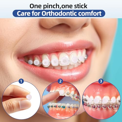 90 Strawberry Scented Orthodontic Wax Dots for Braces