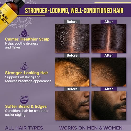 Organic Jamaican Black Castor Oil - 4oz for Hair Growth & Scalp Care