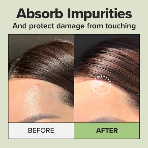 I DEW CARE Timeout Blemish Plus Hydrocolloid Acne Patches, 36 Count