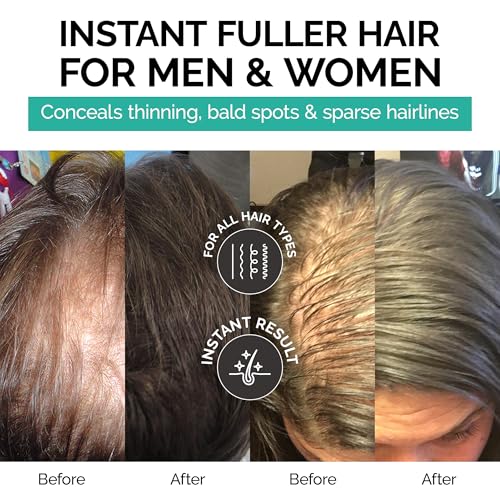 Caboki Hair Fibers for Thinning Hair ? Natural Plant-Based Hair Powder for Men & Women ? Instantly Thicker Fuller Looking Hair ? Clean Ingredients ? 30g, 90-Day Supply, Dark Brown