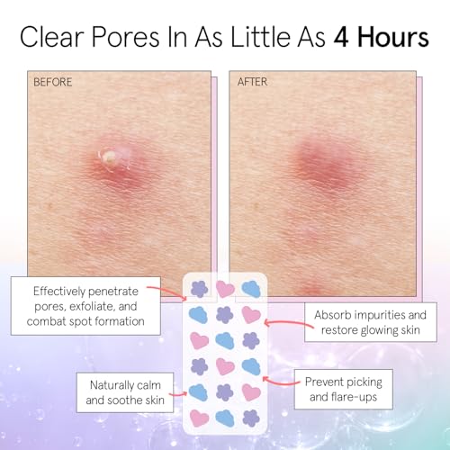 grace & stella Hydrocolloid Acne Patches - 72 Count Pimple Stickers