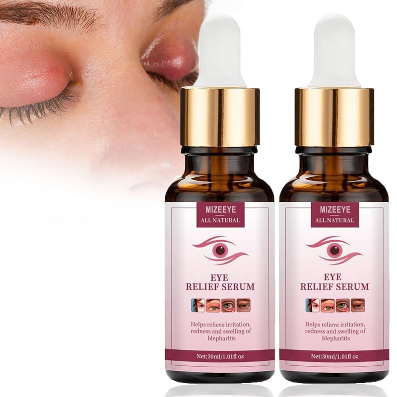 MIZEEYE 2PCS Eye Relief Serum for Blepharitis & Chalazion, Moisturizing Under Eye Care