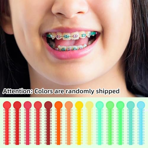 1040 Pcs Multi-Color Orthodontic Ligature Ties for Braces