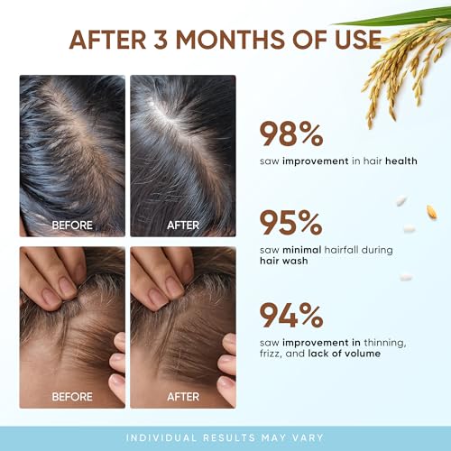 Svvimer Rice Water Hair Growth Shampoo with Biotin for Thinning Hair