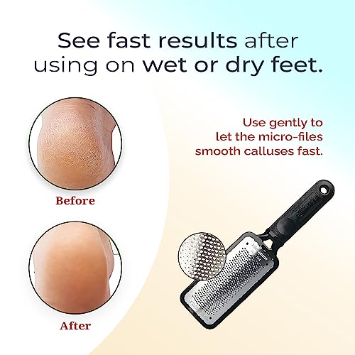 Microplane Colossal Foot File - Stainless Steel Callus Remover