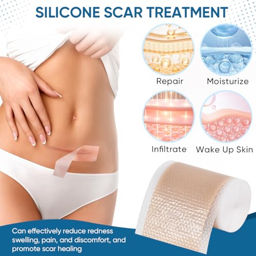 KISEER 2 Rolls Silicone Scar Sheets 1.6 x 60 Inch for Scar & Keloid Removal
