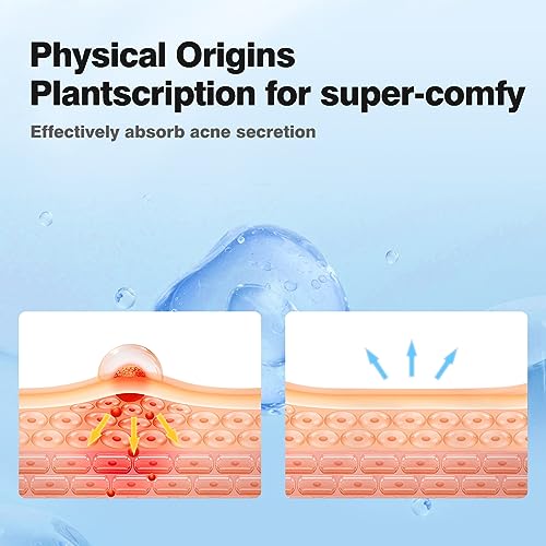 QUSTERE Pimple Patches for Face - 800 Count Hydrocolloid Acne Stickers in 10 Colors