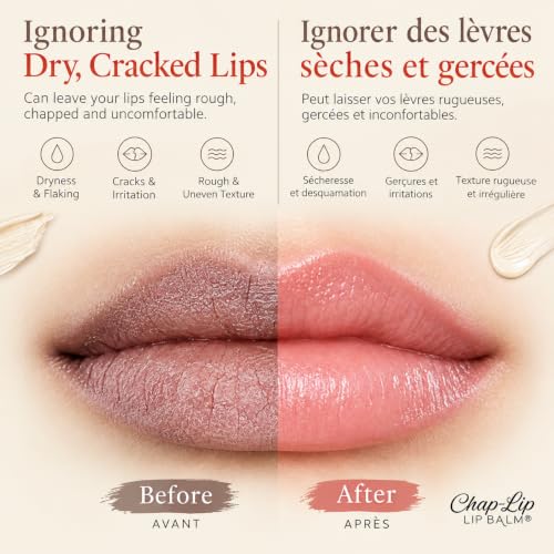 Chap-Lip Original Lip Balm 24 Pack - Hydrating Fruit Flavors with Coconut & Cocoa Butter