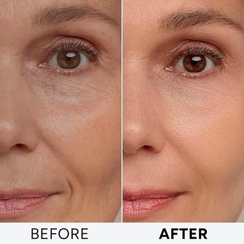 Arvesa Retinol Face Cream with Collagen & Hyaluronic Acid - 2 Pack