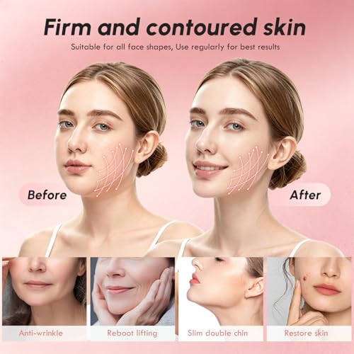 Pink Chin Lifting Mask - Breathable Double Chin Reducer for Women