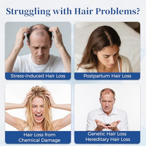 Hair Growth Serum Roll On with Rosemary & Saw Palmetto | 0.84 Fl Oz