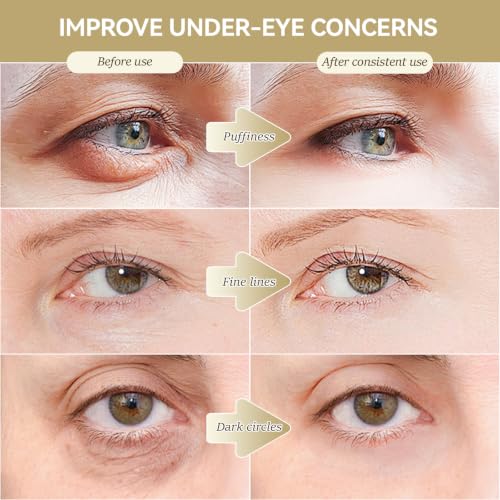 Cocurb Organic Castor & Frankincense Eye Serum with Quartz Roller (5 Pack)