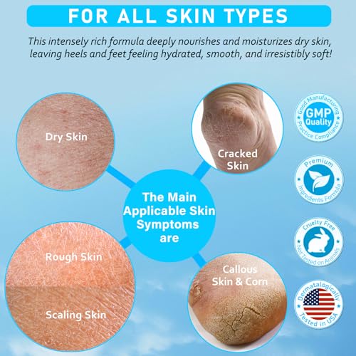 Aphesia Urea 40% Foot Cream - Deep Moisturizing, 5.3 Fl Oz