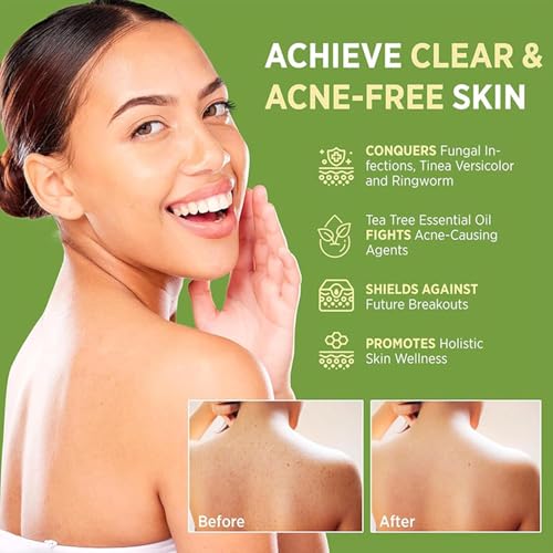 Natural Tea Tree Soap Bar - Gentle Exfoliating Relief for Skin