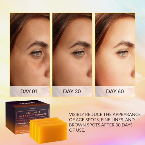 VALITIC Kojic Acid & Turmeric Dark Spot Remover Soap Bars 3 Pack - 3.52 oz each