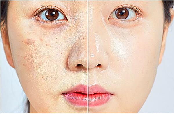 Human Stem Cell & PDRN Anti-Aging Serum - 12 Vials (120ml) for Youthful, Radiant Skin