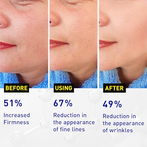 Enaskin Naturals Vitamin C Face Serum 1.7 Oz for Anti-Aging & Brightening - Mature Skin