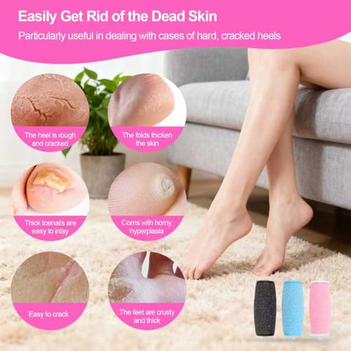 15 Piece Set Replacement Rollers for Amope Pedi Foot File - 6 Extra Coarse & 6 Regular Coarse