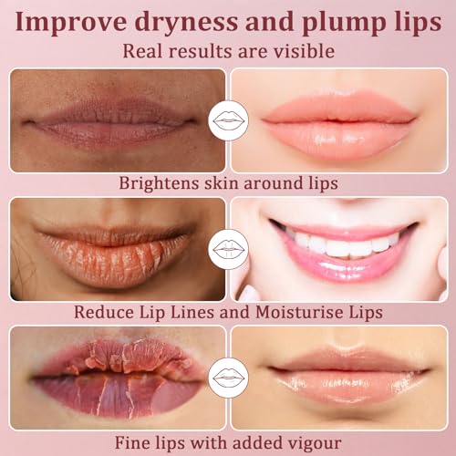 RAINFLOW 30PCS Hydrating Lip Mask Patches for Dry Lips