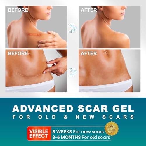 UNIEDI Advanced Scar Gel for Surgical & Keloid Scars - 50g